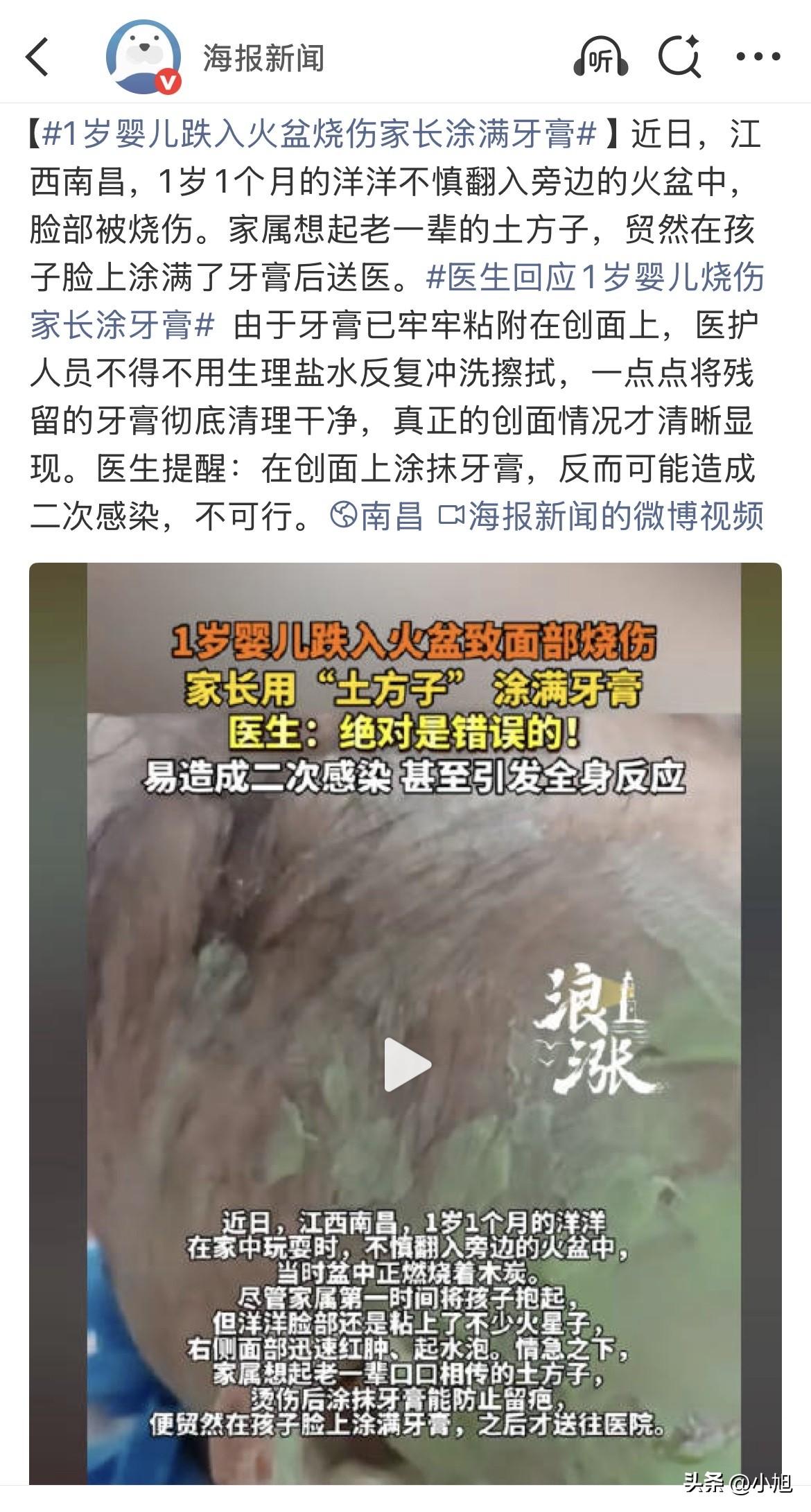 真的服了，南昌那个一岁一个月的孩子，翻进火盆里，脸烧了。家里人一看，慌了，转身去