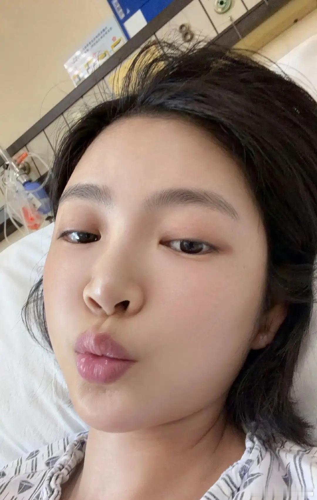 杜淳老婆生病住院，38岁王灿晒病房照，刚做完手术，切了一片肺，躺在病床上脸色蜡黄