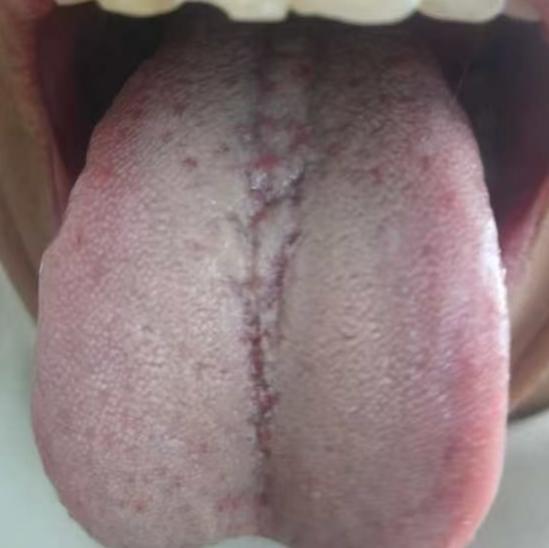 男人疲软不要瞎补阳！根源大多是精血亏虚






很多男同志一旦出现了痿弱的问