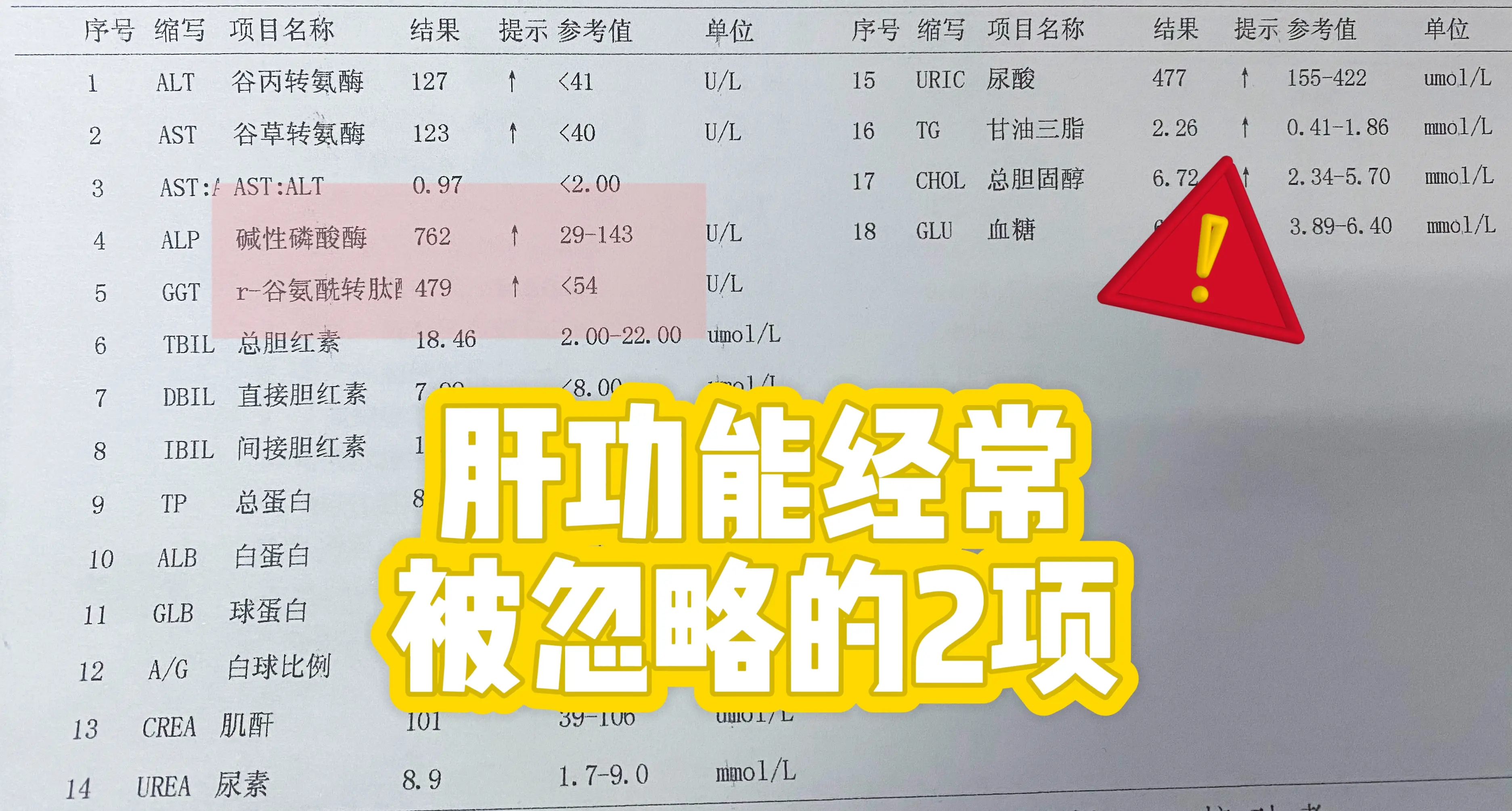 肝功能经常被忽略的2项！ 谷氨酰转肽酶和碱性磷酸酶是肝功能化验中经常被...