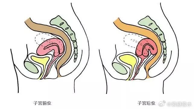 后位子宫不容易怀孕吗？其实关于前位子宫和后位子宫的诊断大可不费周折，因为前位和后