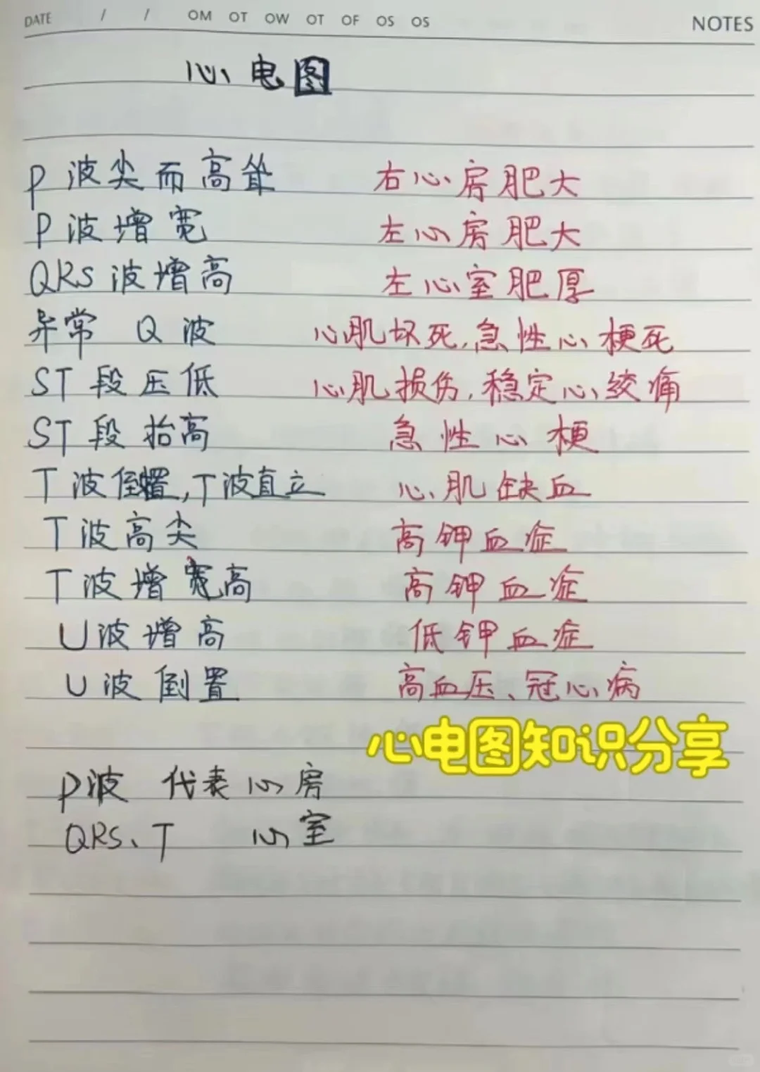 心电图知识分享