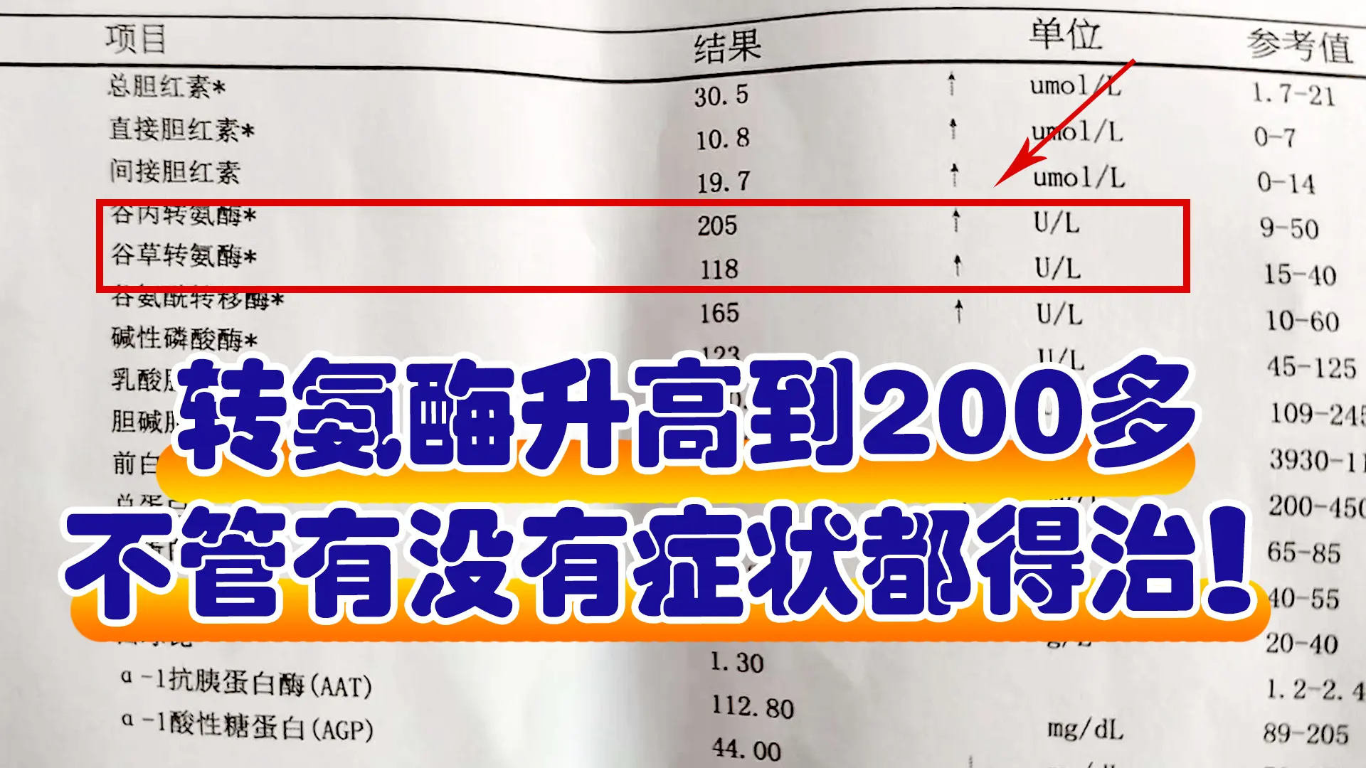 转氨酶升高到200多，不管有没有症状都  这是一位乙肝大三阳患者，乙肝...