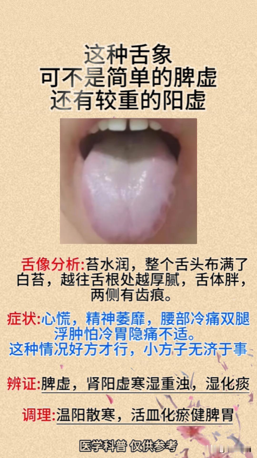 脾虚阳虚你真的了解吗？
#舌诊##舌象分析##舌诊案例分析#