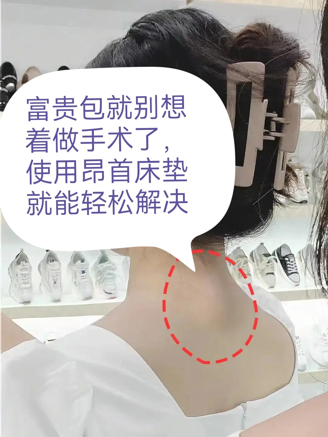 富贵包别做手术了，用昂首床垫可轻松解决！