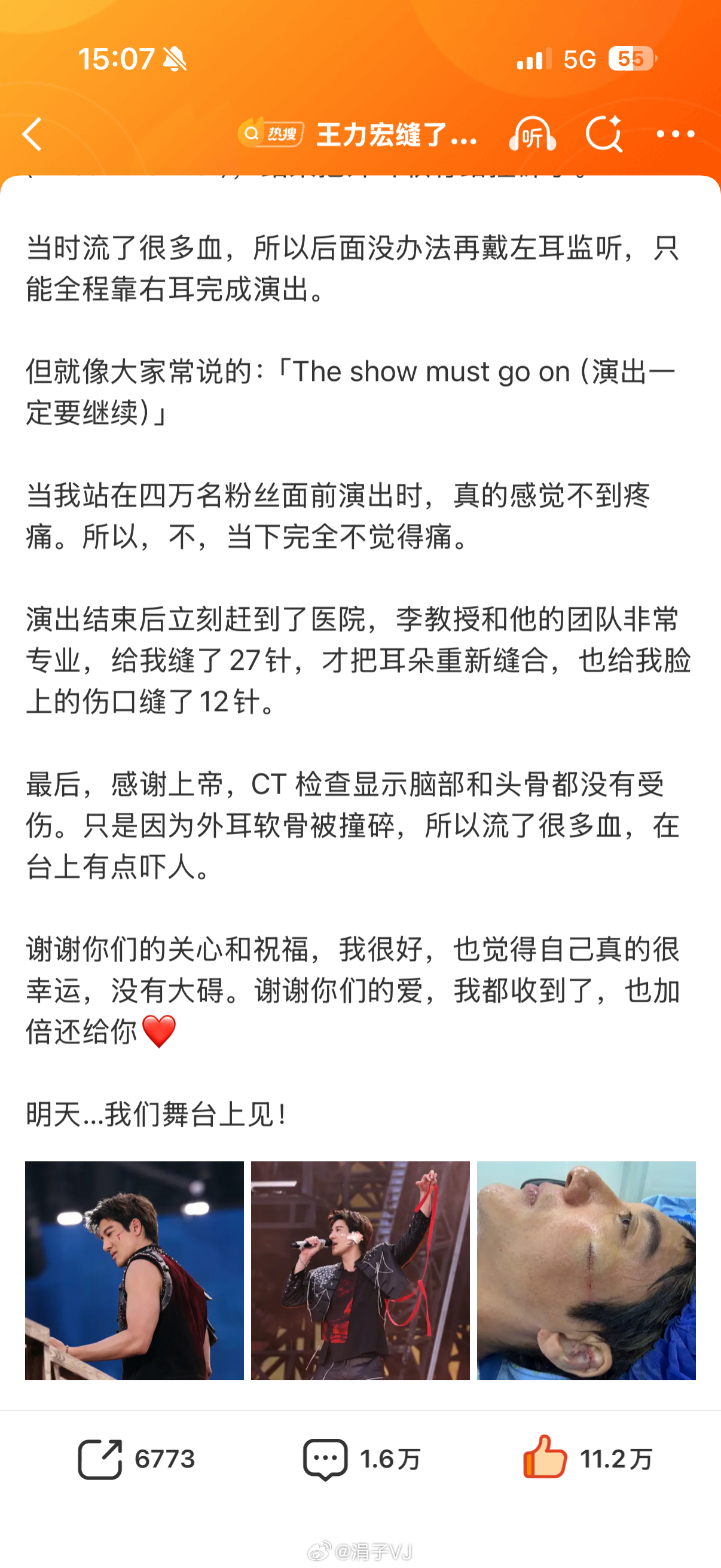 王力宏对这次事故的回应很值得学习，没有抱怨和咎责，虽然脸上都缝了针，但是依旧感恩