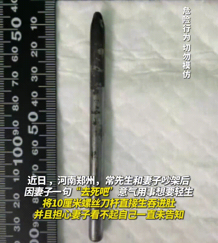 河南郑州，一位妻子和老公吵架，嘴太损让老公去世，老公一气之下吞下10cm螺丝刀，