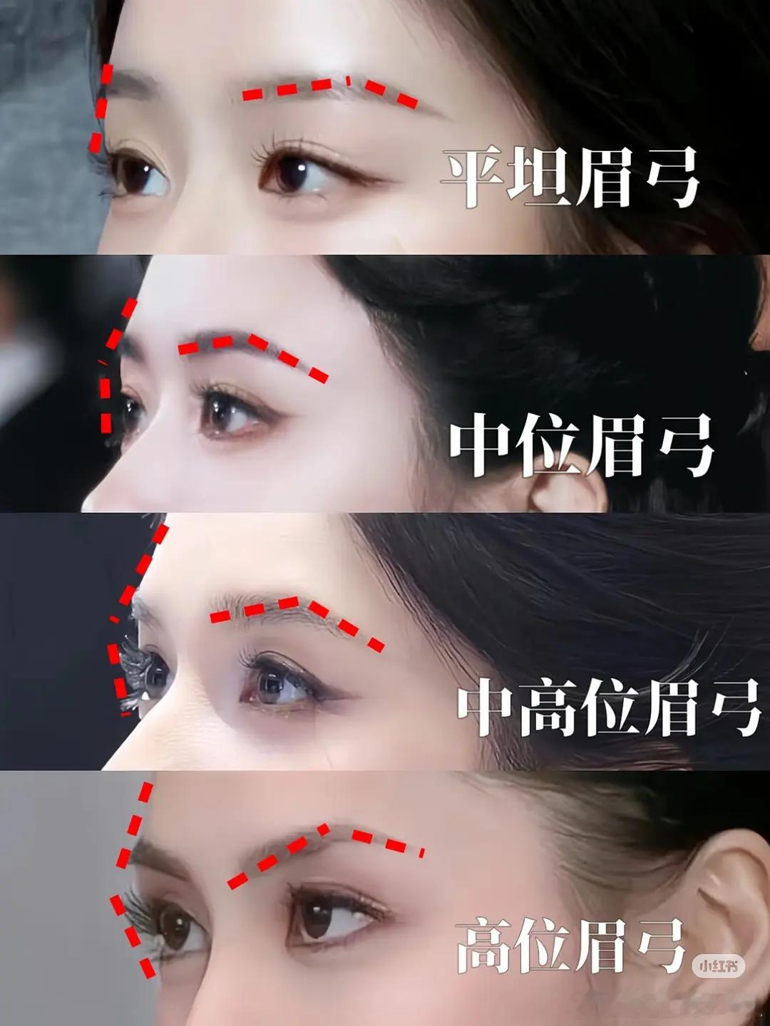 赵今麦 绿野仙踪 赵今麦的眉弓看着很奇怪吗？是眼睛的问题还是眉弓的问题？ 