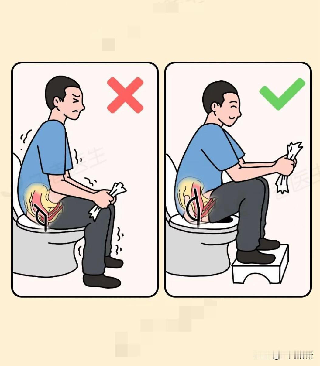 分享一个实用小妙招：
蹲马桶的时候，
脚上垫一个小凳子！
这样，我们的肠道就是一