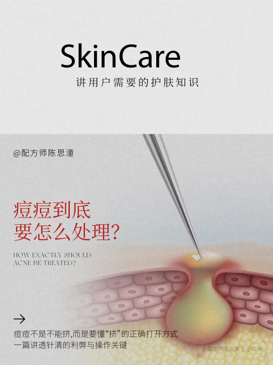 护肤知识｜痘痘到底要怎么处理？