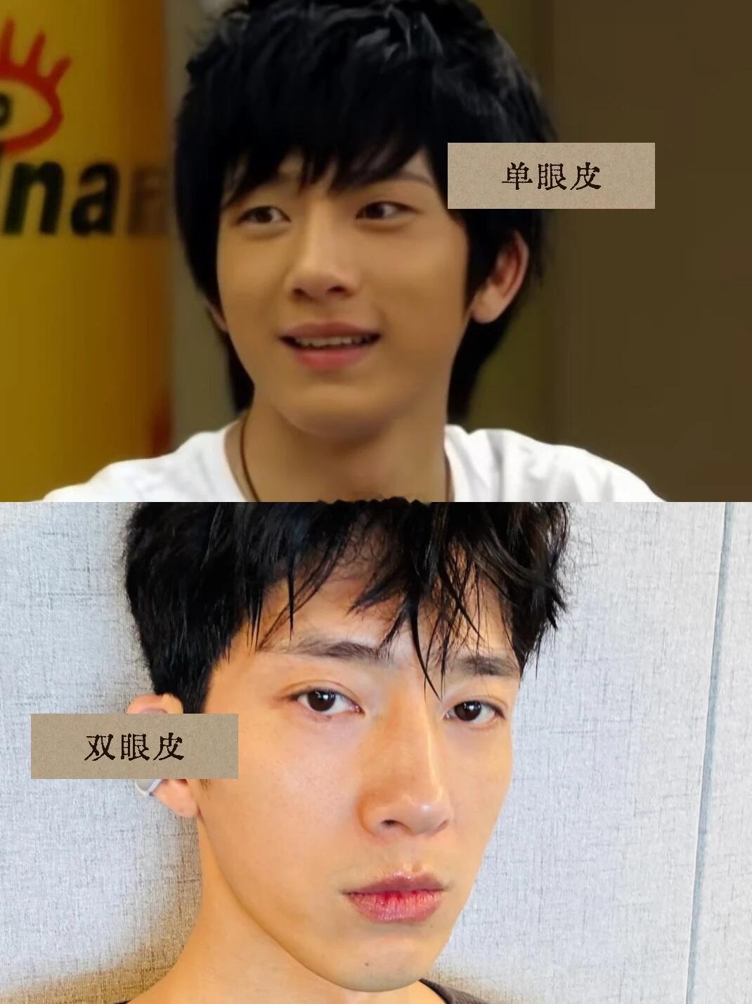 井柏然咋变成双眼皮的 ​​​