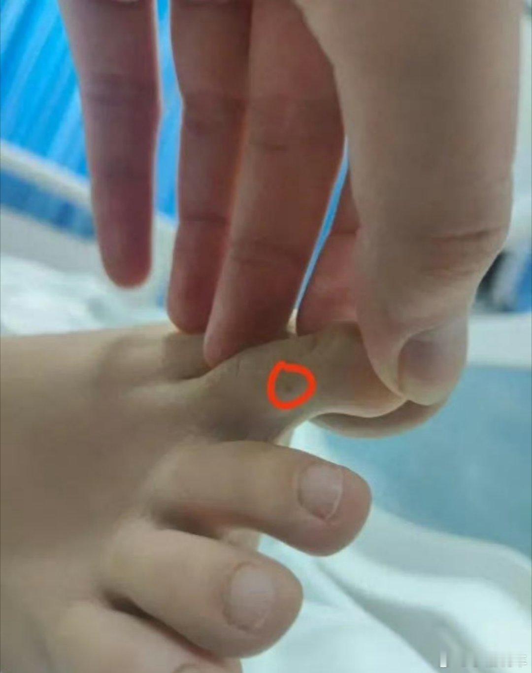 被咬身亡女子家属回应为何不尸检太吓人了，就这么小小一个口就让一条生命逝去，肯定要