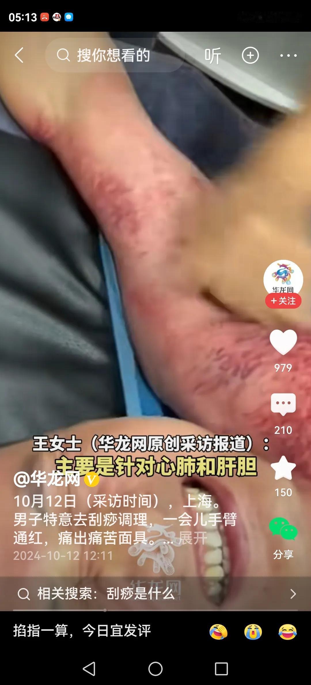 #男子刮痧调理被刮出“痛苦面具”#
刮痧刮痧，视频里的男子被刮的似哭非哭，似笑非