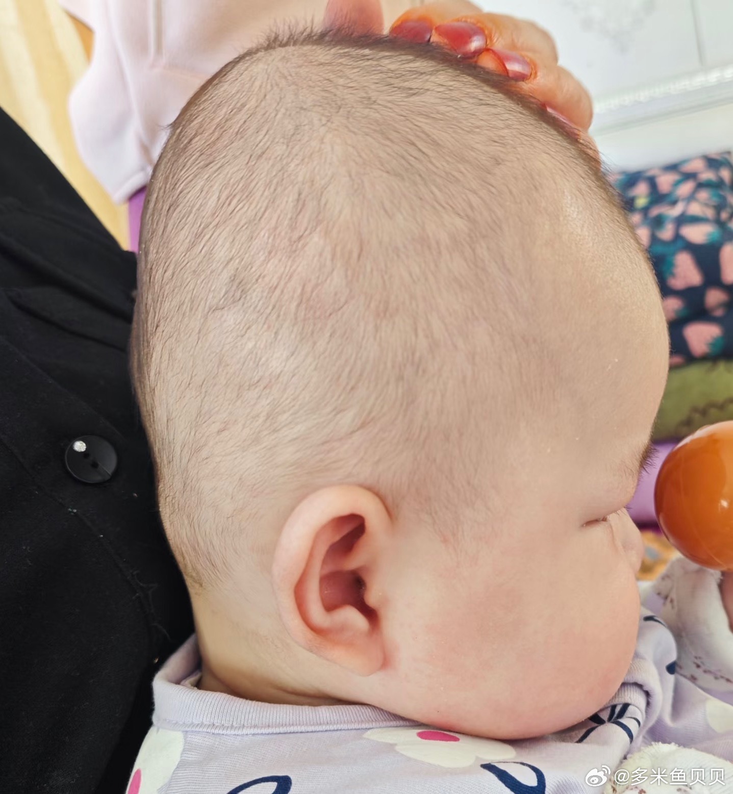 大扁头 还有救吗现在刚4个月 已经左右开始睡了 后面还能拯救回来吗 当初为了睡枕