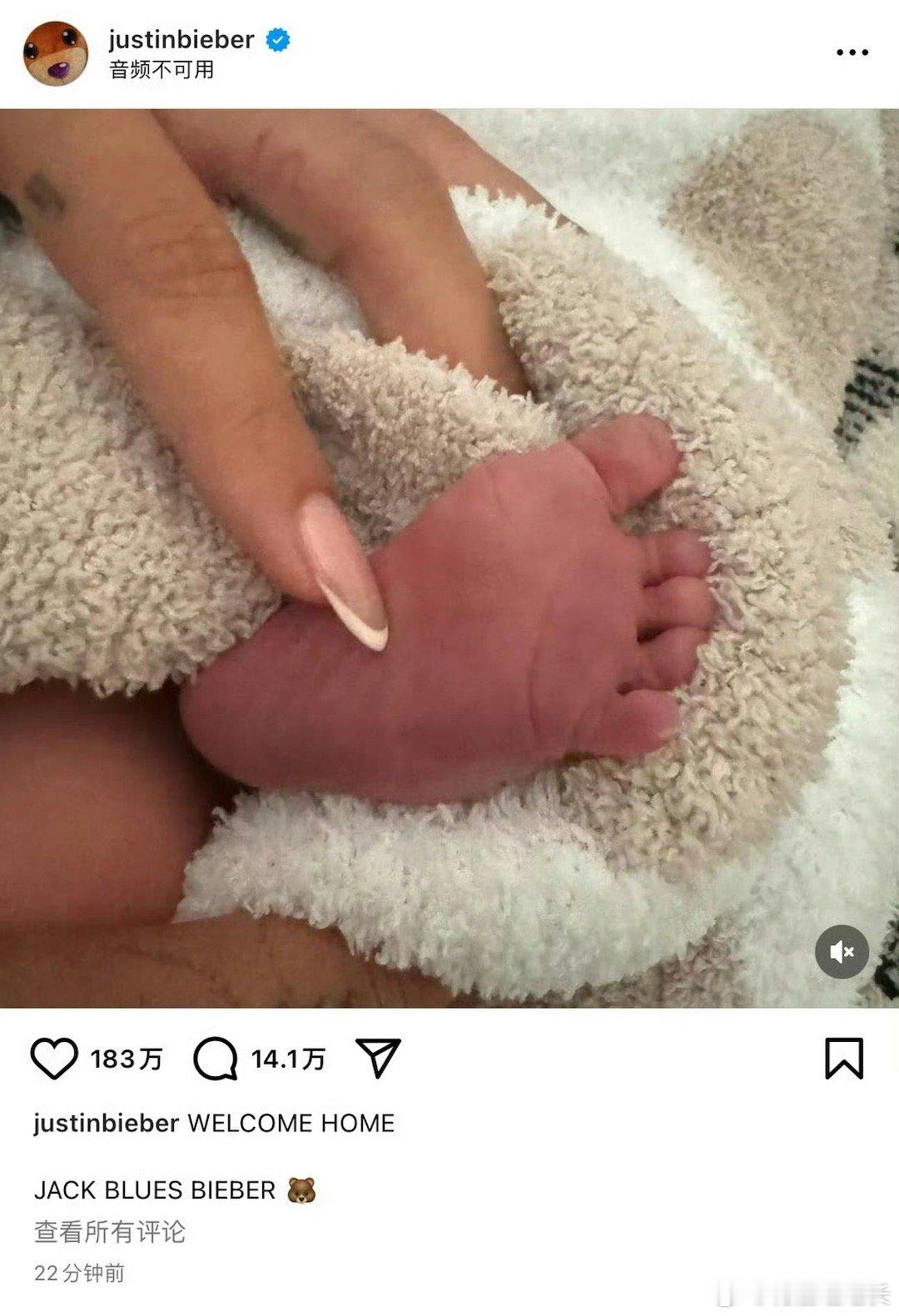 #比伯海莉孩子出生##新浪娱乐[超话]# 海丽长得真的不好看[裂开][裂开][裂