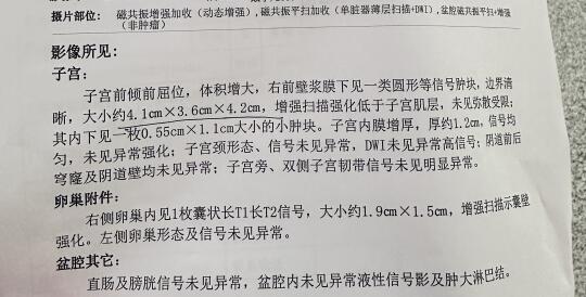 有没有带瘤怀孕的姐妹们