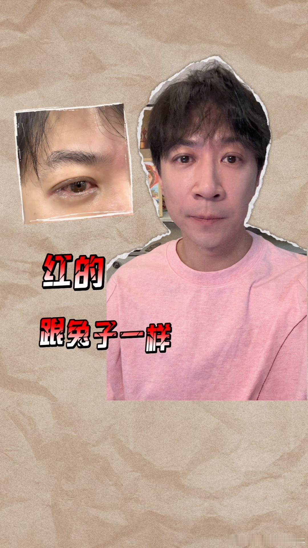 张维伊这次是真红了张维伊当导演写轮眼了第一次扛下导演重担，日夜打磨剧本，一双红眼