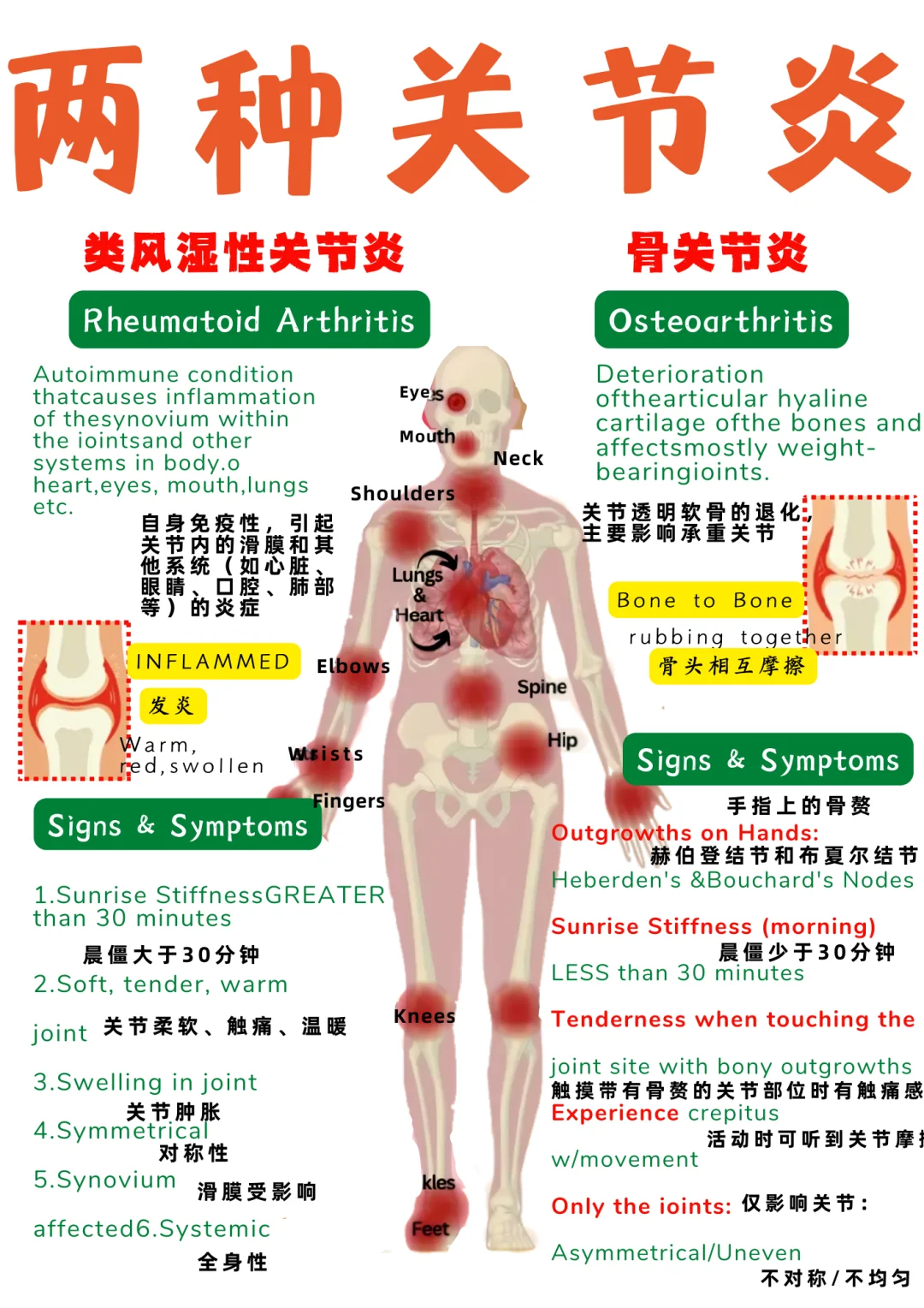 备考RN/两种关节炎！！学！！单词