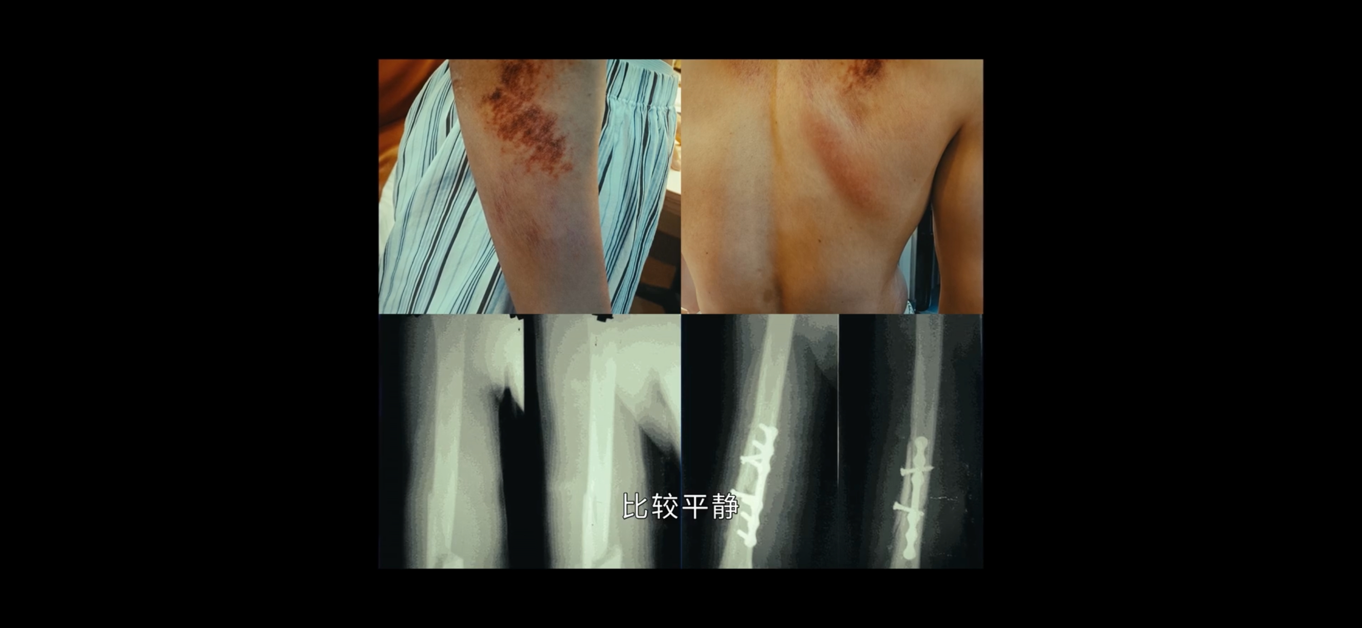 林方路应该怎么也想不到，他来到清水镇接手的第一个案 子，嫌 疑 人居然就是曾经的
