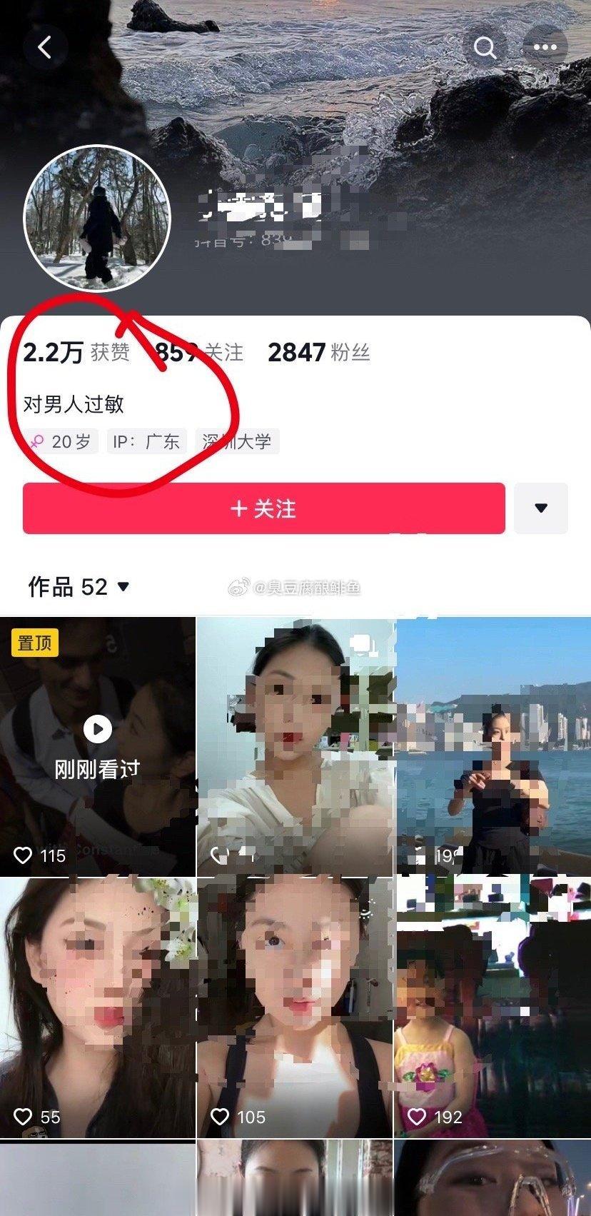 对男人过敏。。。哦但不对洋人过敏这是啥病症？ ​​​