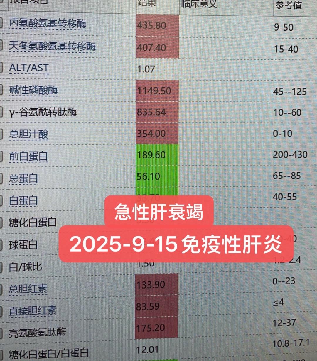 PD1单抗后免疫性肝炎的识别与治疗。联合治疗时，通常采用排除分析法！排...