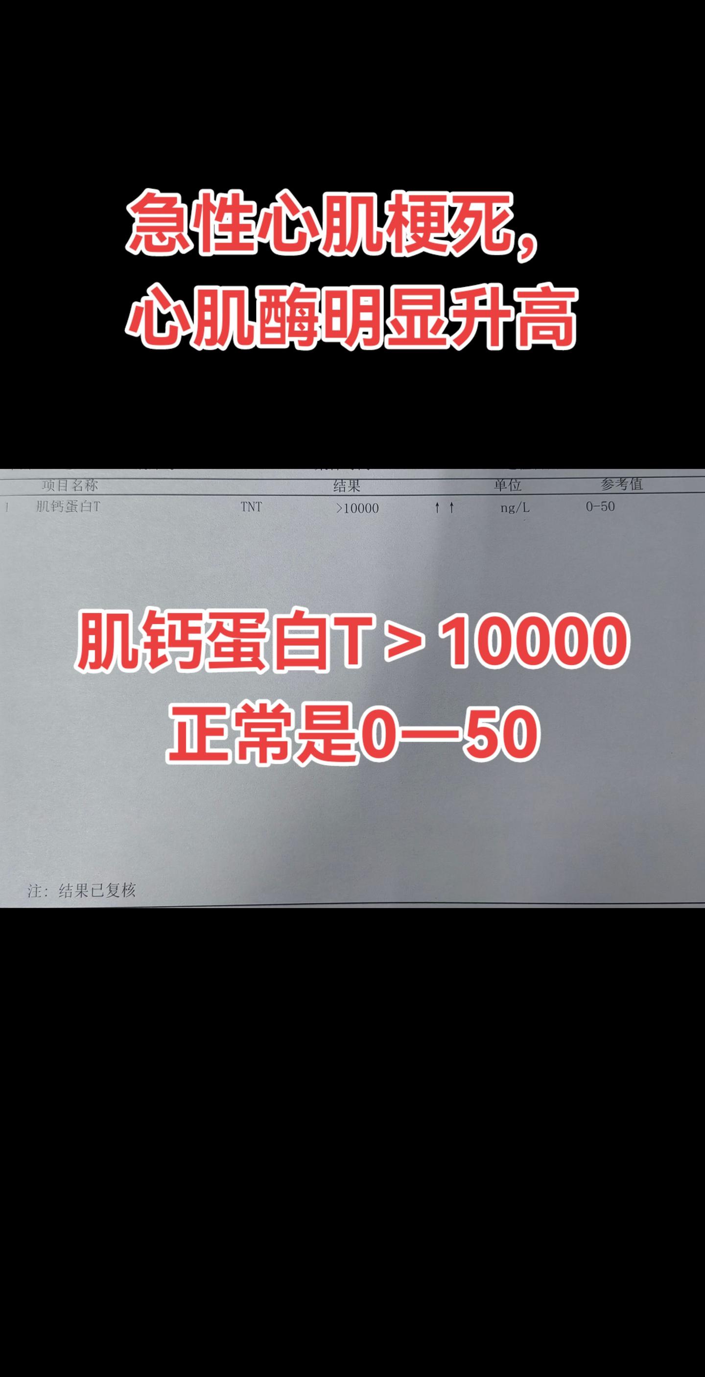 急性心肌梗死。患者为老年女性，因突发心前区疼痛两小时就诊，入院之后查心...