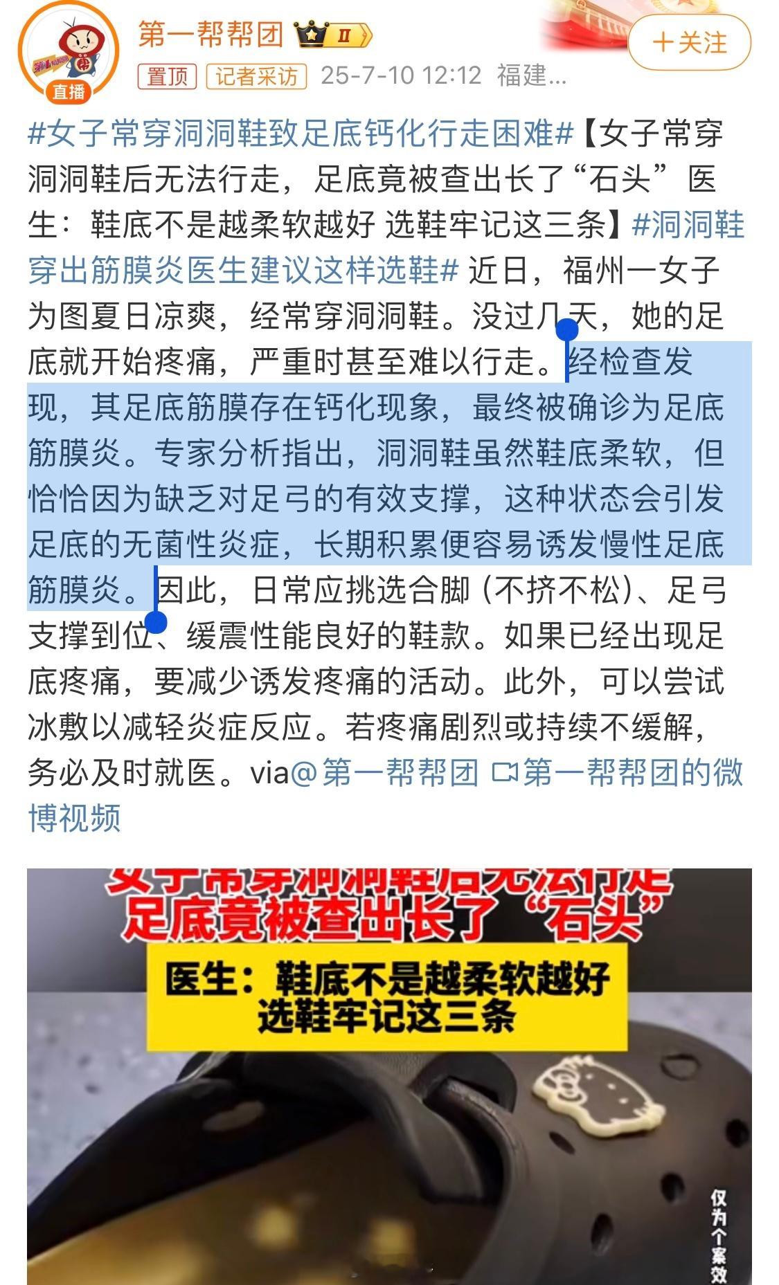 洞洞鞋是这个世界上最丑的鞋之一，不知道为啥那么多女生喜欢穿，我从来没有刷到哪个富