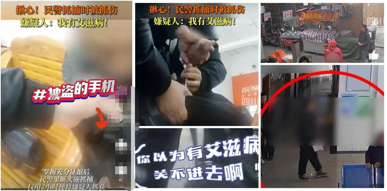 艾滋病不是"免死金牌"！民警英勇抓捕遭患艾嫌犯咬伤，坚决捍卫法律尊严




“
