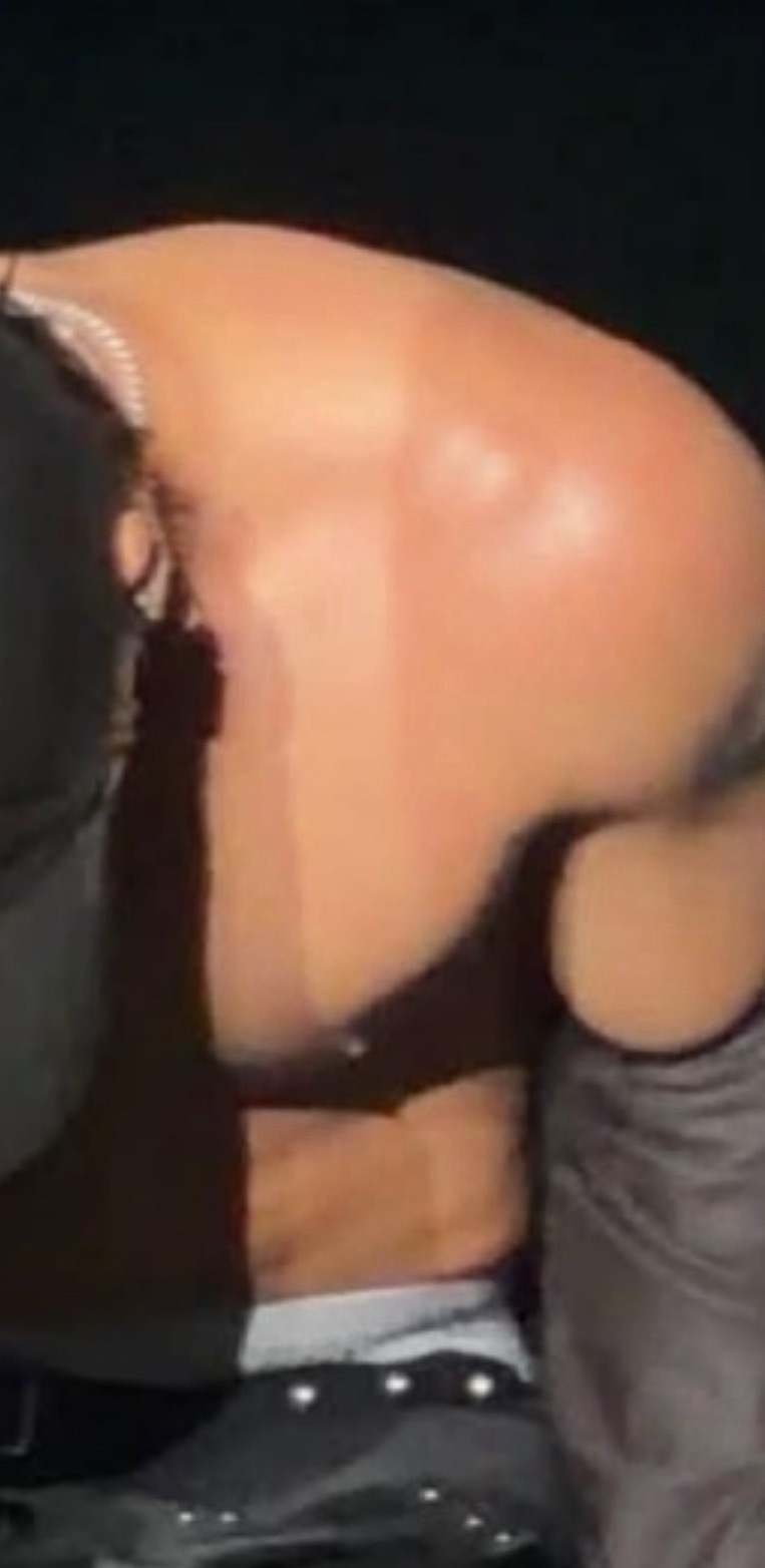我不行了这印子咋这么明显 ​​​