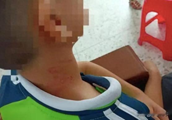 “校长就可以打人了？”广东廉江，一男孩因为升旗没有带红领巾，便被学校的校长掐脖子
