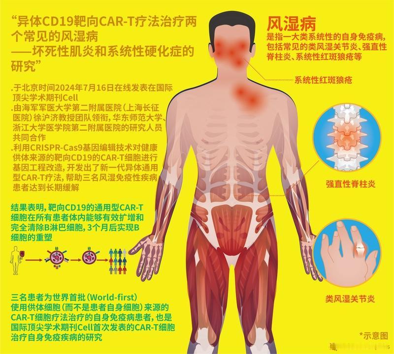 当下，网络上爆火的CkT细胞免疫疗法，即CAR - T疗法，宣称一针就能消除癌细