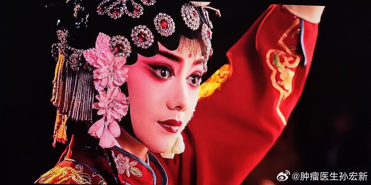 我的门诊故事  今天下午的国际医疗部门诊，第一个患者是43岁女性乳腺癌。非常可惜