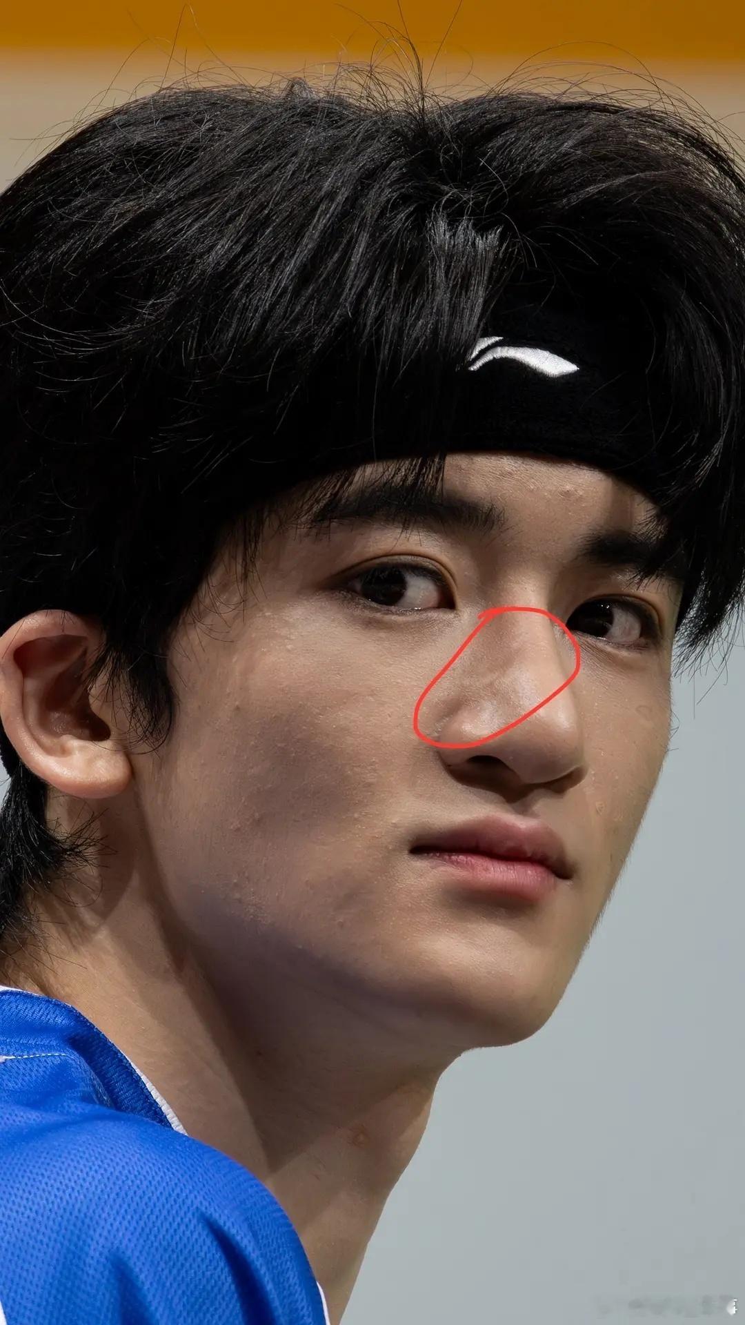 天啊，刀口这么明显都不做修复的吗[疑问] ​​​