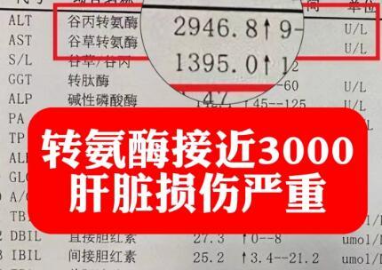 肝功能转氨酶升高分为两种情况，一种不用管，一种必须治！
临床上常见的转氨酶参考值