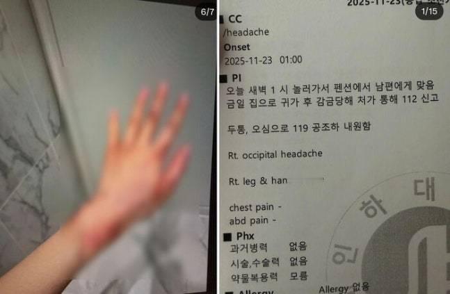 【SBS演艺】一名女性近日主张，自己长期遭到一名"人气女团成员亲哥哥"的男性施加