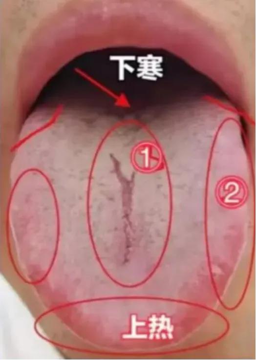 公益舌诊，你拍我看，挨个分析！
舌诊