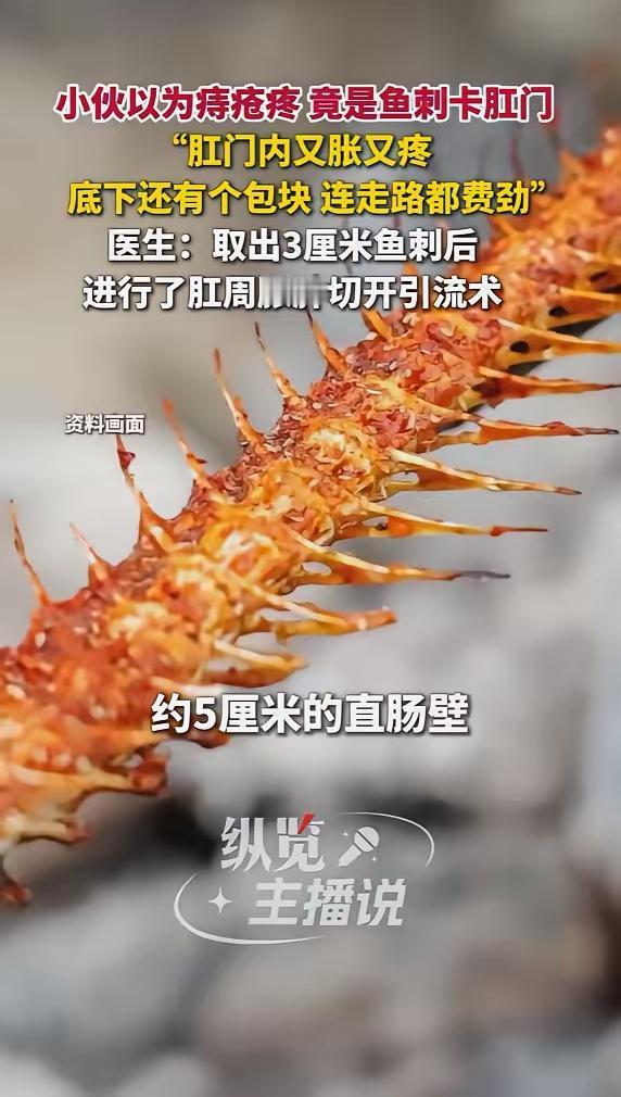 丢人丢大了！广东，一男子最近屁股又胀又疼，以为是痔疮犯了，忍了好几天，结果越来越