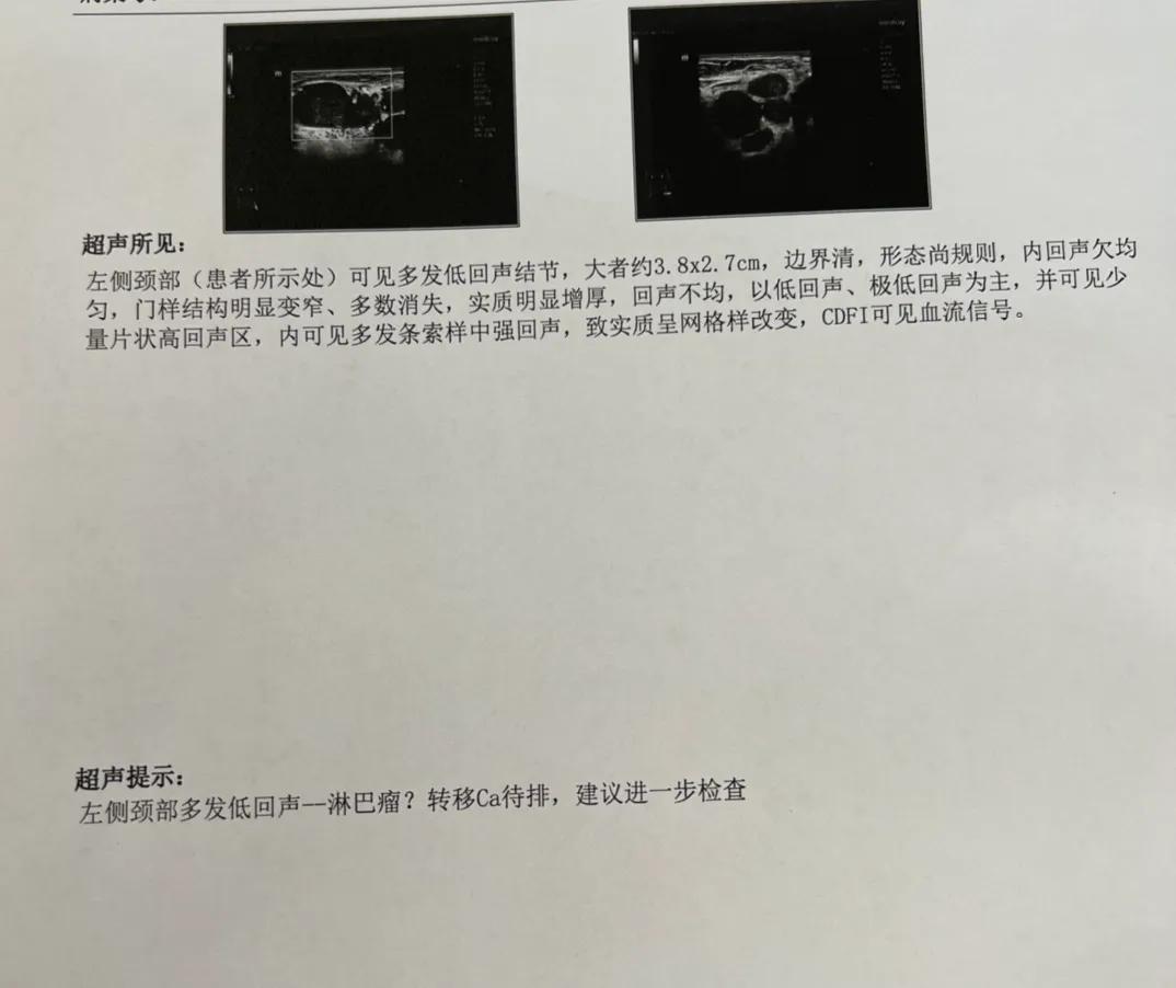门诊的一个患者，两天前在脖子上摸到一个包，今天做了一个彩超，结果不太好，有可能是