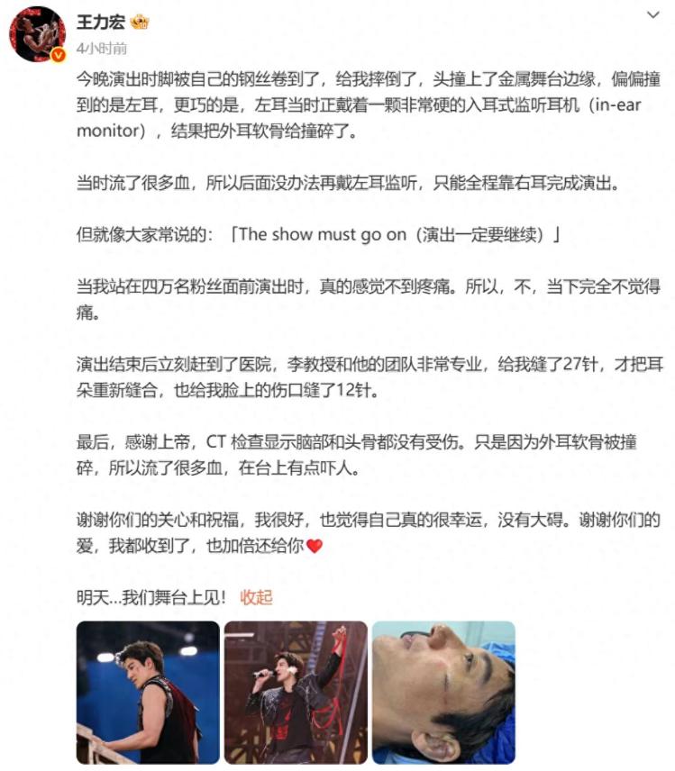 王力宏带伤硬撑完演唱会，结束后赶往医院，耳脸缝了39针。

真正的顶级敬业，永远