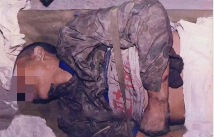 1987年，老山前线，一名牺牲的解放军战士静静地躺在担架上，我们从他紧握的双拳可