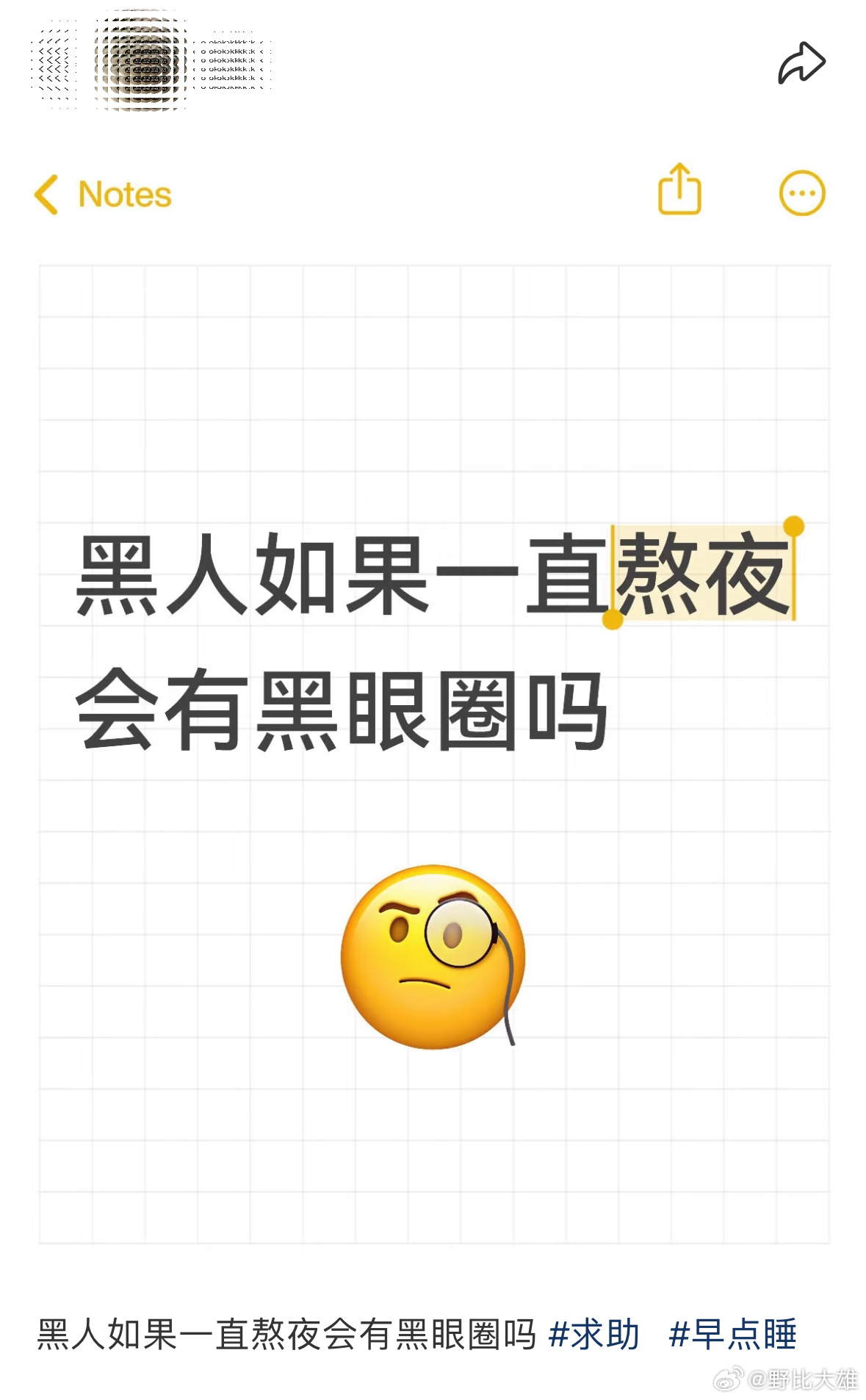 黑人如果一直熬夜也是会有黑眼圈的😂一个奇奇妙妙的思考方向！黑人也能测出黑眼圈非