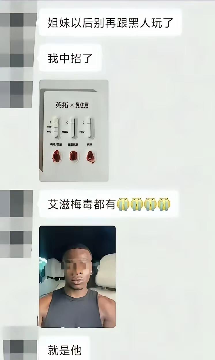 自作孽不可活，这就是追求刺激的后果。有的女人，就喜欢体验新鲜感，这回，连肠子都悔