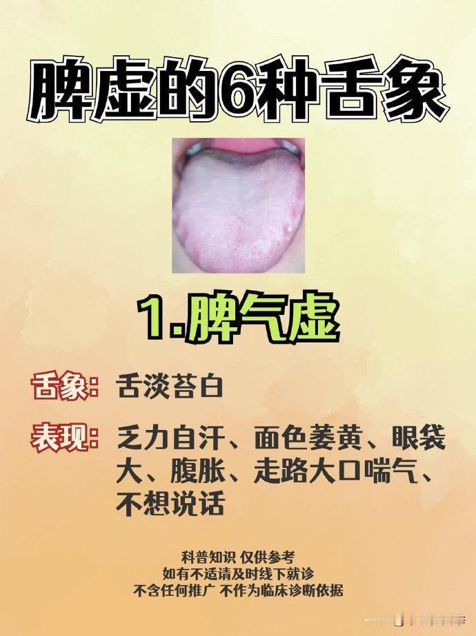 脾一虚，人就废一半了！6种脾虚舌象，看看你属于哪一种
#中医##养生#