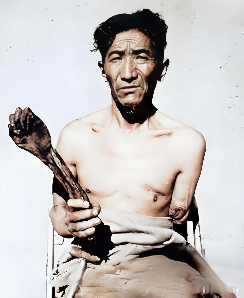 在旧西藏那段黑暗而残酷的历史篇章中，一位农奴展示了他那被无情砍去的胳膊，这一幕不