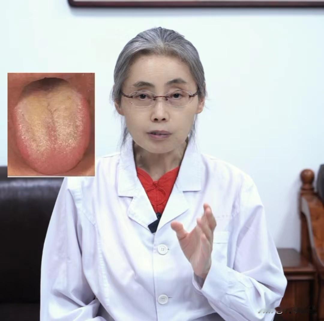出现这种舌象，千万别再直接从补入手了，小心越补越虚

患者主诉：口臭，尿频尿急，