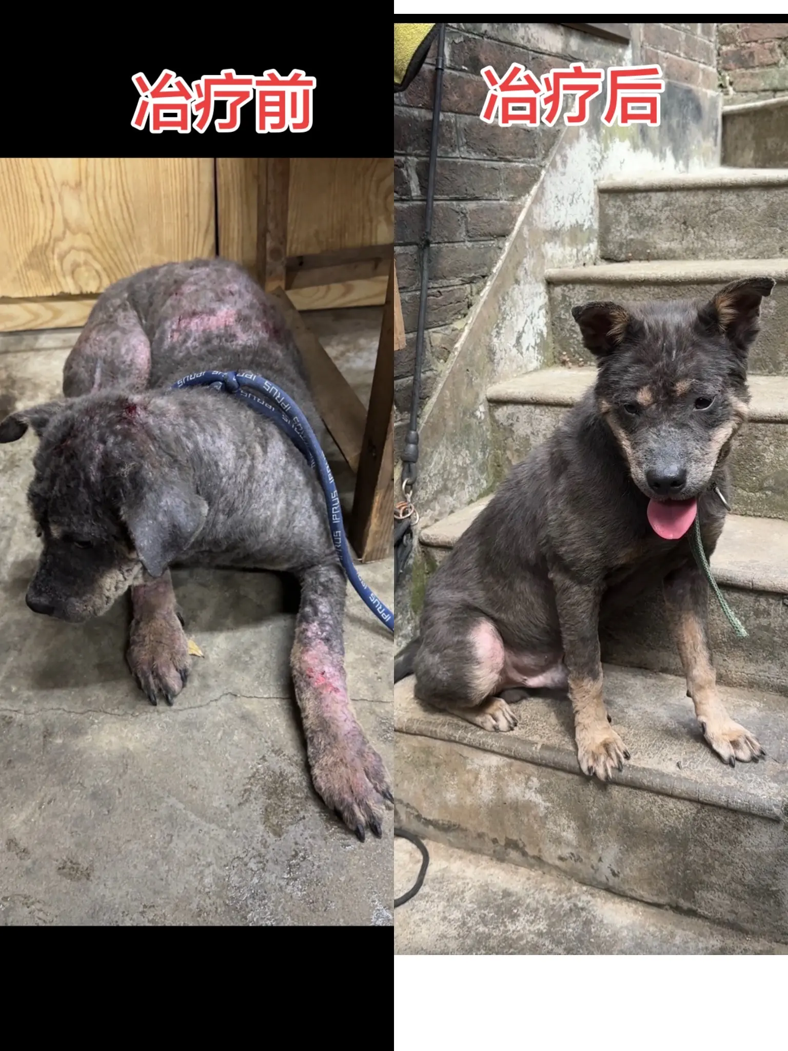 我们用一个月冶疗好了