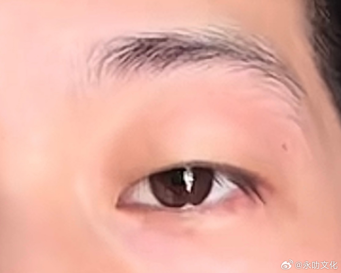 男性，如图，眼睛无神，眼皮偏耷拉，睫毛长但是向下生长，从健康上来说，容易出现失眠