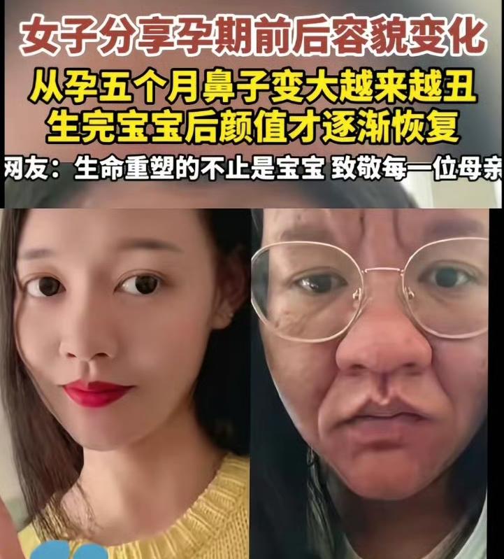 云南一位32岁的孕妈阿芹火了，不是因为别的，而是她怀孕前后容貌的巨大反差。怀孕前