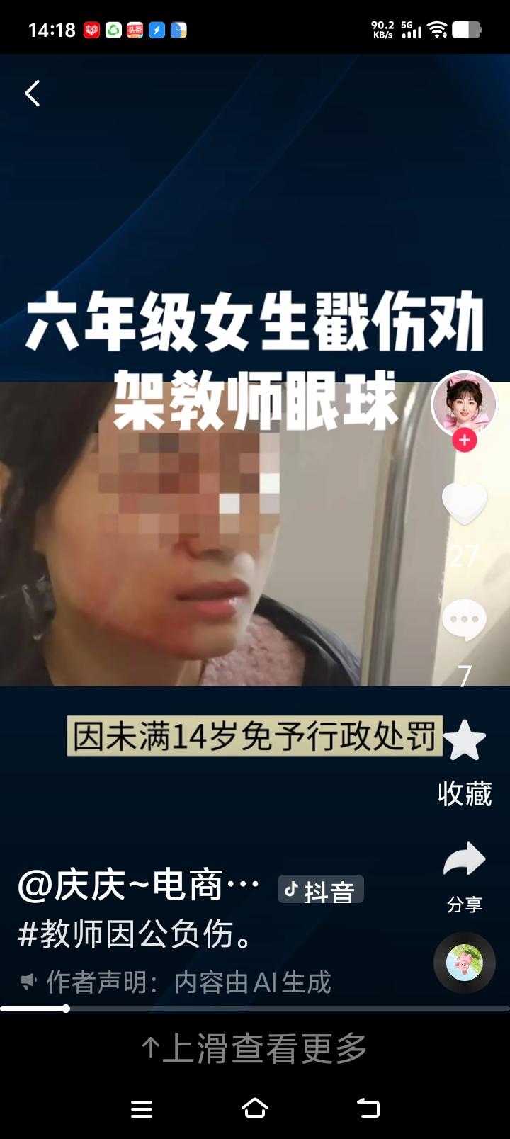 宋老师太冤了！

瑞安宋老师的眼睛还要做第三次手术，虽然女生家长支付了医药费，但
