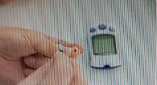 空腹血糖7.5mmol/L先别慌，这可不等于就确诊糖尿病了。单次血糖值就像考试发